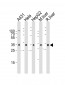 CYB5R3 Antibody (Center)